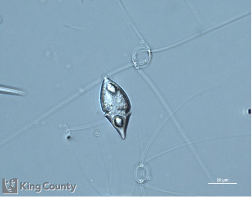 Photo of Amphidinium sphenoides